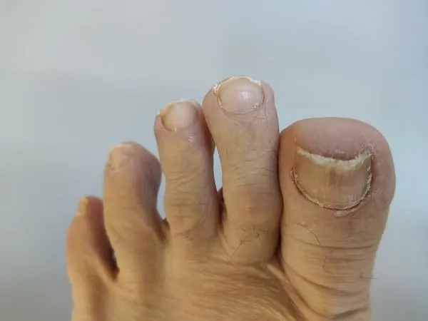 K-Pro Nagelzange für dicke Zehennägel 15,5 cm Profi