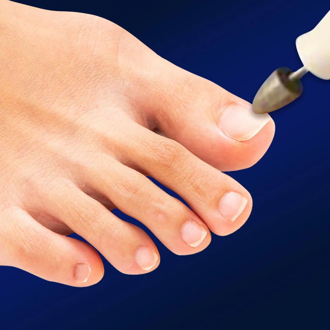 Medicool My Lovely Feet Nagelfräser Set Batterie Hornhaut
