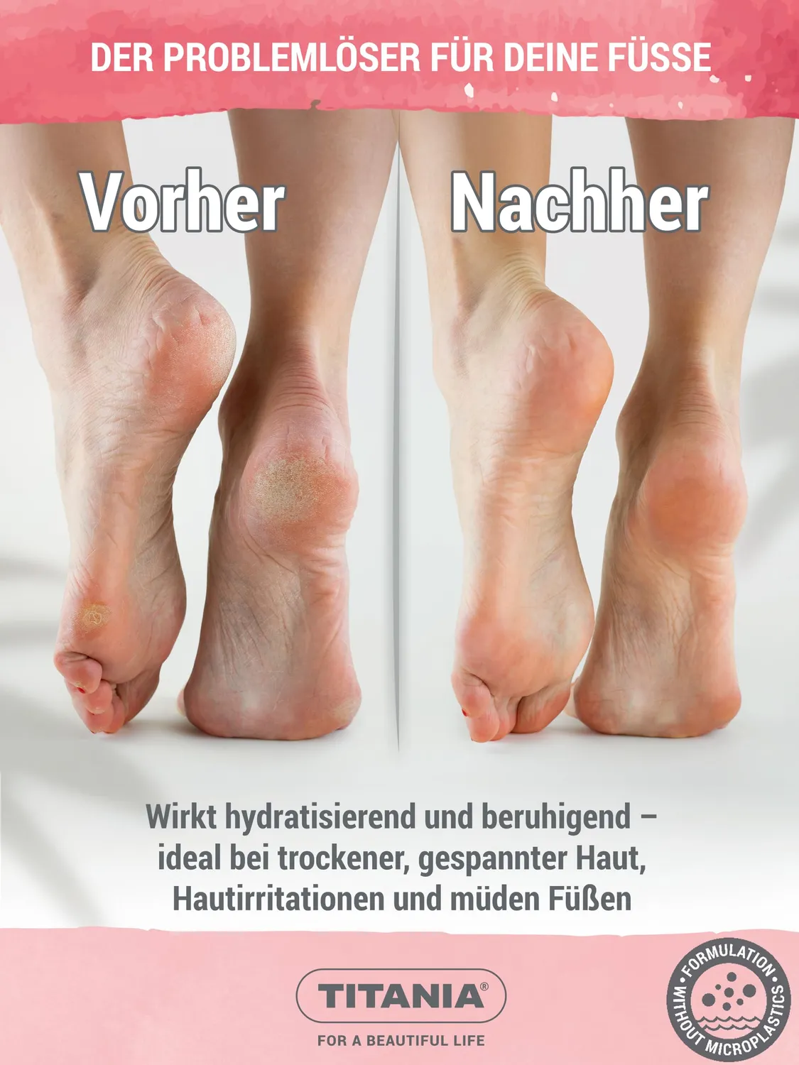 Titania Fußcreme Urea 10% 75 ml für sehr trockene Füße
