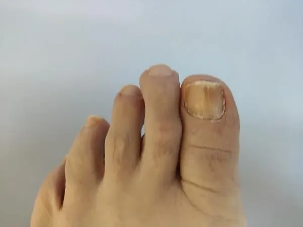 K-Pro Nagelzange für dicke Zehennägel 15,5 cm Profi