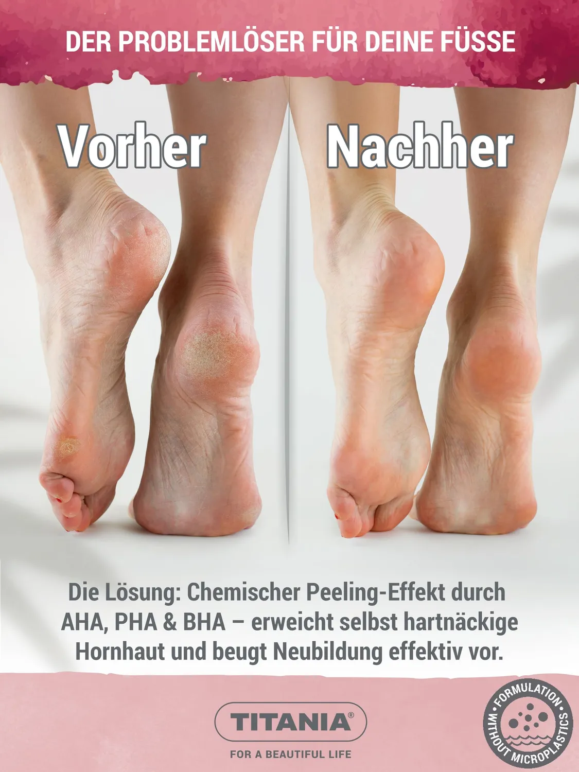 Titania Hornhaut Killer Fußcreme 75 ml Urea Peeling