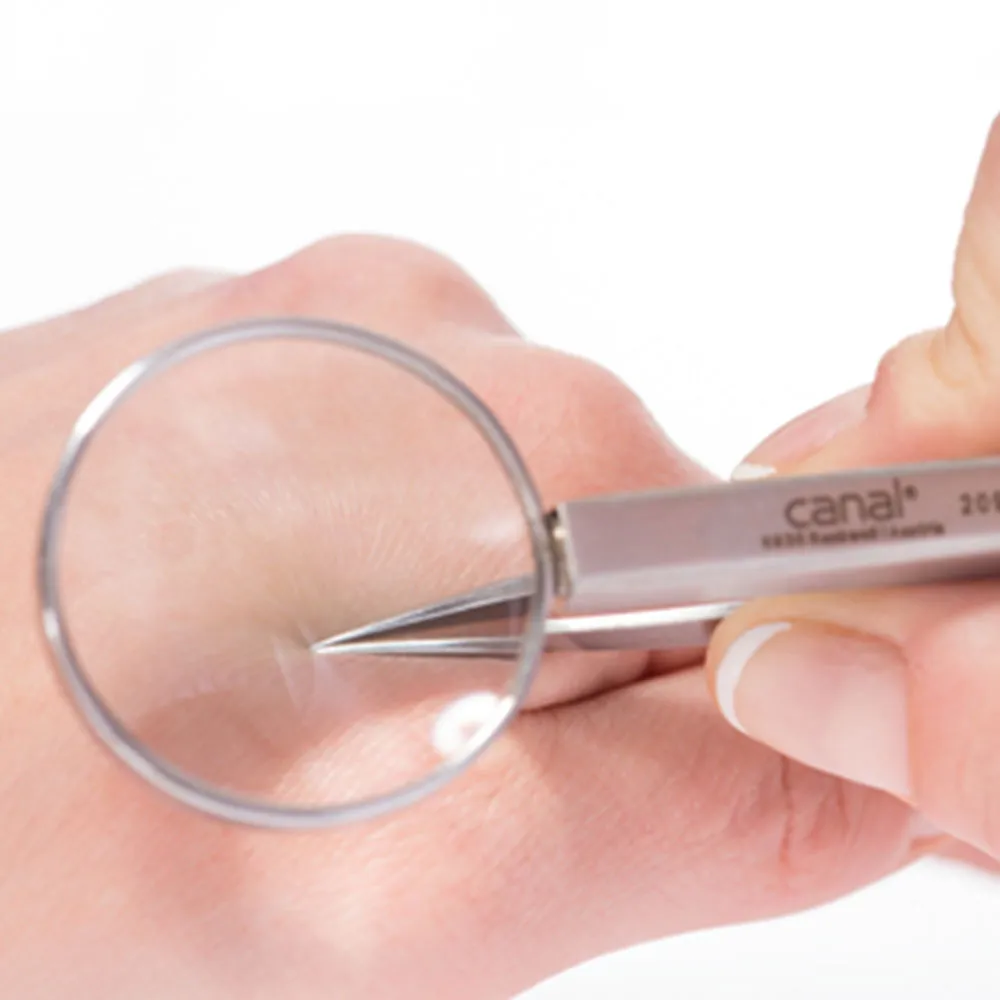 Canal Instrumente 2098-02 Splitterpinzette Lupe 12 cm Edelstahl