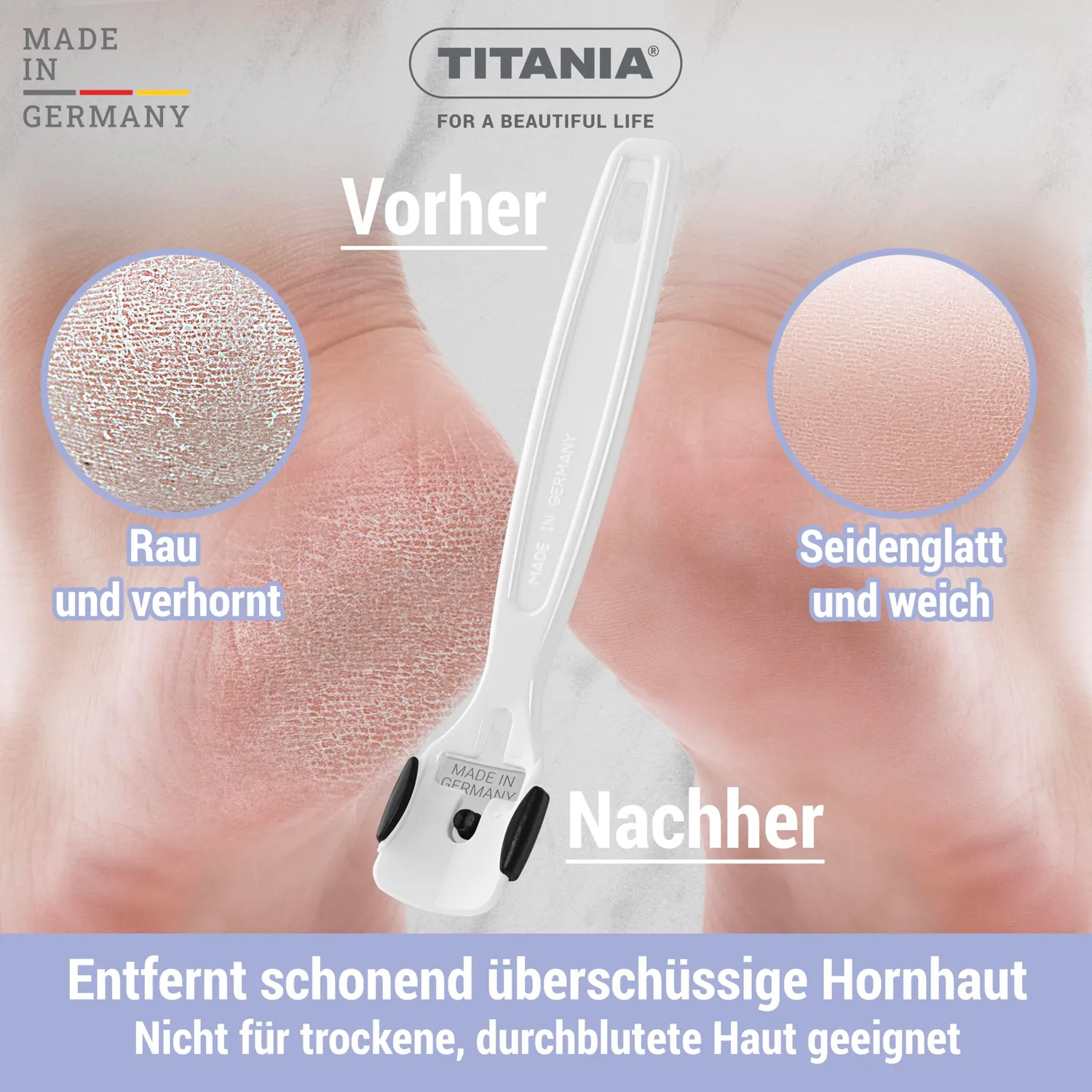 Titania Hornhauthobel Kunststoff mit Klinge Fußpflege